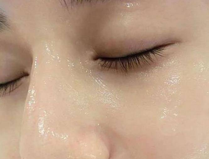 「它」是斑點皺紋的剋星，米醋加點它，老年斑、妊娠斑、雀斑、青春痘不見了好神奇