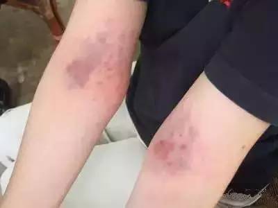 每天拍這裡，拍出腎毒，腸毒，肝臟毒，毒素一下就清得乾乾淨淨~ 連醫生都讚不絕口！