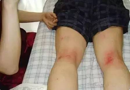 每天拍這裡，拍出腎毒，腸毒，肝臟毒，毒素一下就清得乾乾淨淨~ 連醫生都讚不絕口！