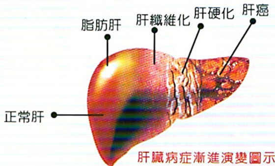 注意！容易疲勞的人是肝不好，教你一個「簡單小動作」把健康的肝養回來！