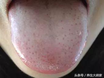 心臟不好，這個地方沒彈性，夏季養心，記住「123」口訣！