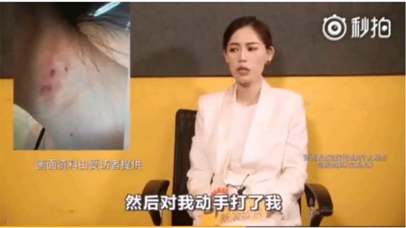 神逆轉！馬蓉淚控被家暴　反咬「王寶強先 出軌」
