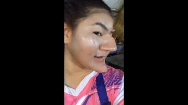 泰女整形完很得意，正面看起來很正常，頭一轉嚇壞眾人：這陳為民吧 