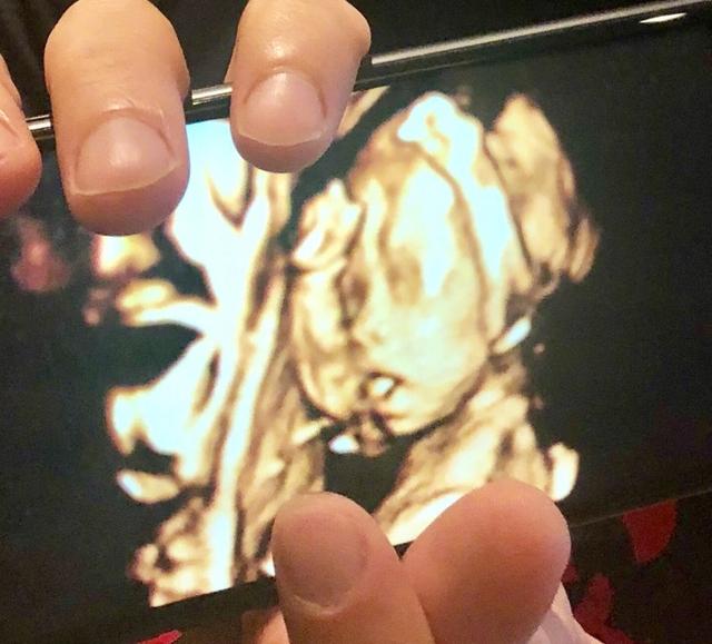 王力宏曬老婆三胎B超照，求網友給兒子取名，評論笑慘了！