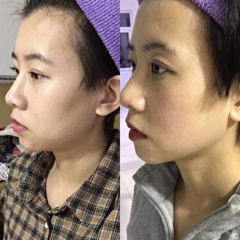 網民大讚效果超級明顯！一星期早晚一套瘦面操，極速消除頑固雙下巴，瘦出瓜子臉同時減淡頸紋！ 