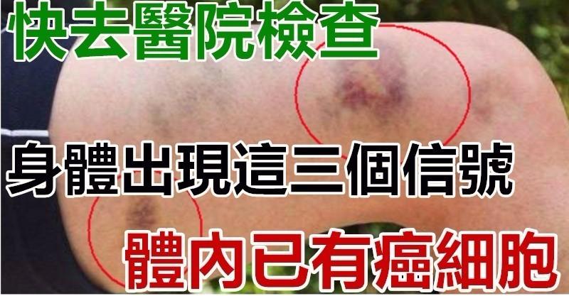 身體出現這三個信號，體內已有癌細胞，快去醫院檢查