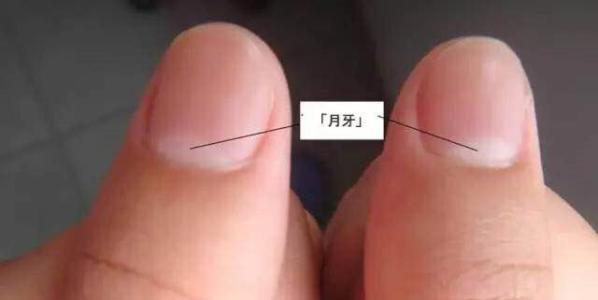 測試：你的大拇指上有這種月牙嗎？測出你的性格運勢！ 