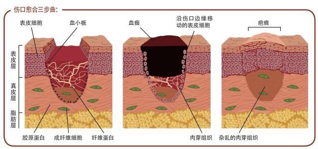 受傷以後，真的不能吃海鮮和「發物」嗎？