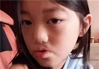 王菲女兒天生兔唇, 經過3次整容後, 現年12歲的她變長腿名模上時裝周！ 