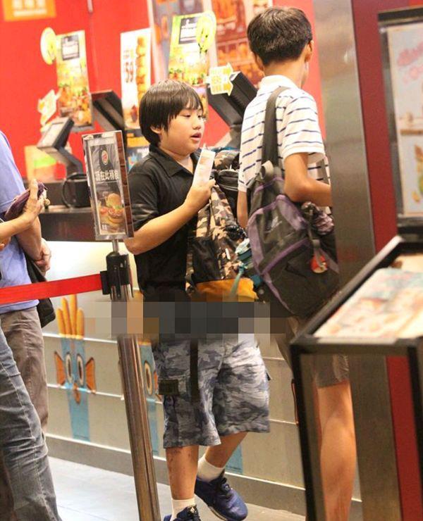 14歲小小彬被爸爸當搖錢樹來還房貸養全家！如今近照曝光，手腳潰爛令人心疼！