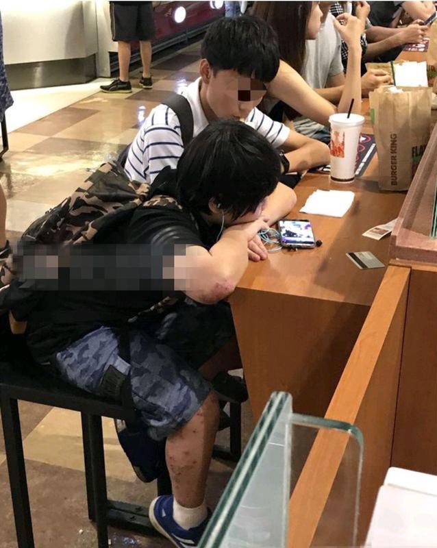 14歲小小彬被爸爸當搖錢樹來還房貸養全家！如今近照曝光，手腳潰爛令人心疼！