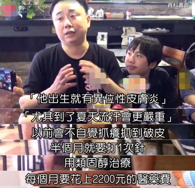 14歲小小彬被爸爸當搖錢樹來還房貸養全家！如今近照曝光，手腳潰爛令人心疼！