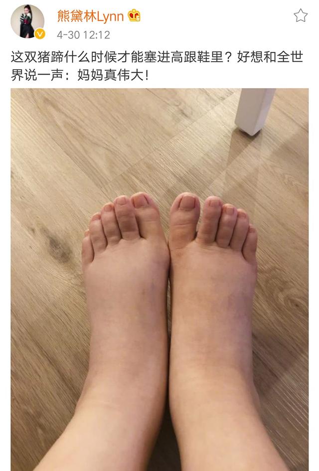 熊黛林稱女兒的小腳丫是多功能「豬蹄」，可供食用和按摩！