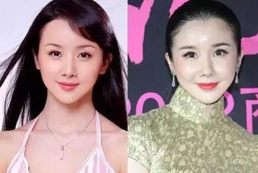 看下這幾位整容失敗的明星，個個都不忍直視！ 