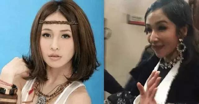 看下這幾位整容失敗的明星，個個都不忍直視！ 