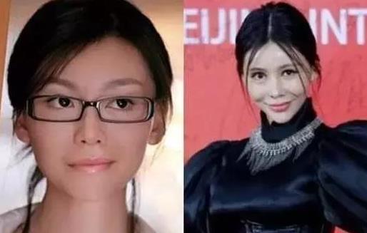 看下這幾位整容失敗的明星，個個都不忍直視！ 