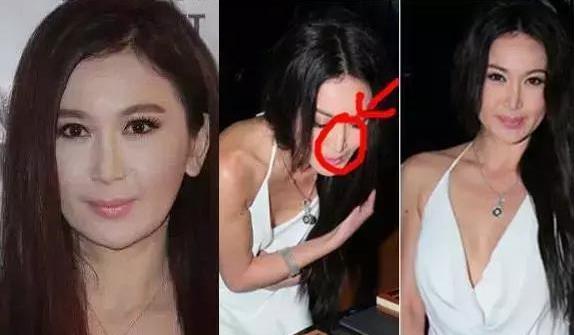 看下這幾位整容失敗的明星，個個都不忍直視！ 