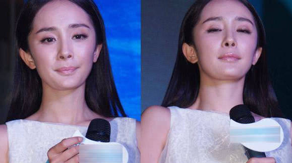 鼻子一捏就塌！女星整容後遺症開始了？楊冪直接垮掉，Baby大變臉，而她嘴歪嚴重！ 