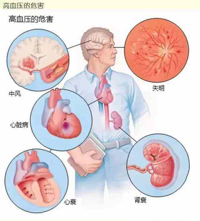 血壓高的人注意，5種食物不要多吃，會讓血壓「直線飆升」