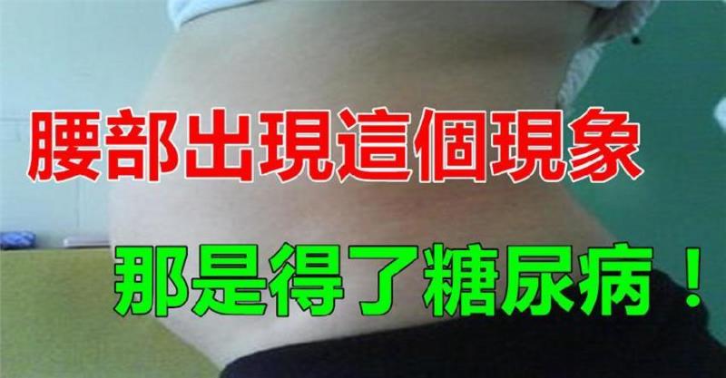 你的腰如果出現這個狀況，可能是患上了糖尿病 