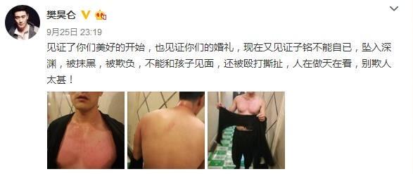 賈靜雯家暴圖片爆光，滿是血跡，樣子淒慘！而他老公還居然這樣！