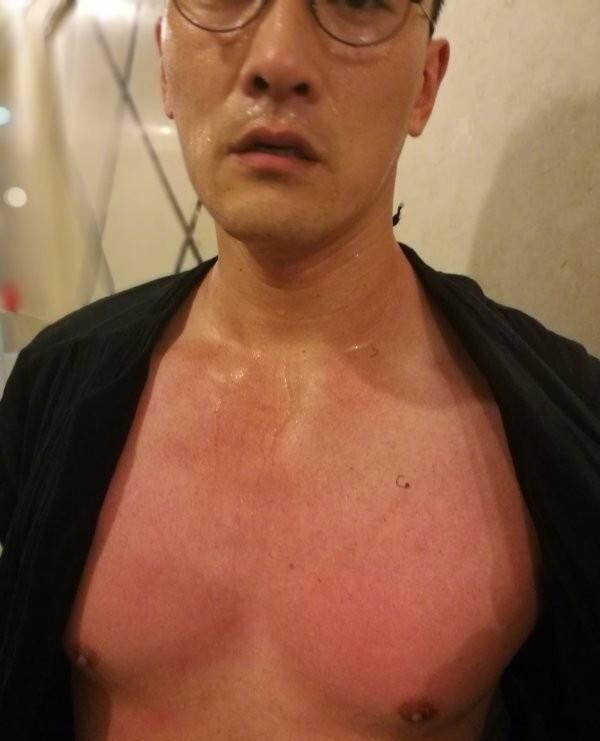 賈靜雯家暴圖片爆光，滿是血跡，樣子淒慘！而他老公還居然這樣！