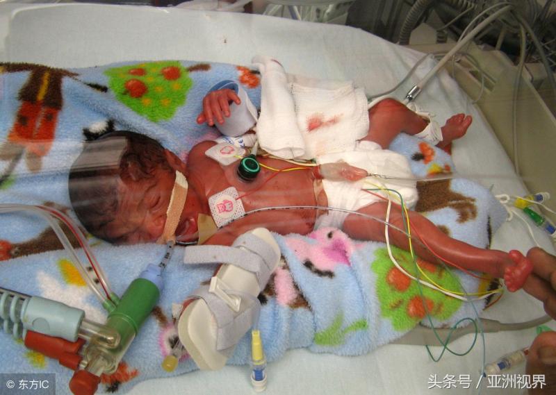 震撼！腦死亡2天，英國滑冰教練為「小丈夫」產下女嬰