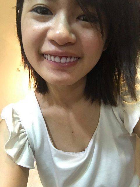 她亂買超廢「假牙玩具」…戴上去「咧嘴微笑」竟美到超過100分！網友：這東西太火了… -
