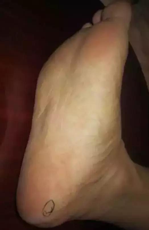 專家推薦：治腰疼、頸椎疼、膝蓋疼，一病一招！太珍貴了~