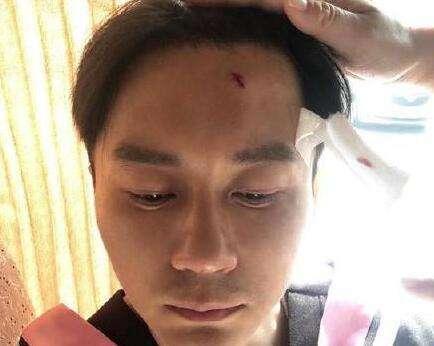 綜藝節目頻出意外李晨縫了22針，而他卻昏迷6天不幸去世