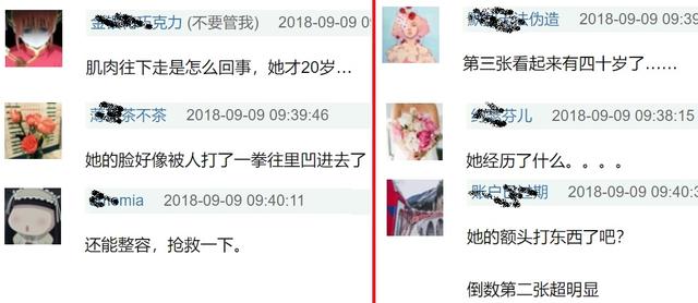 徐嬌上《我就是演員》被網友吐槽太醜，這些年她的臉經歷了什麼？