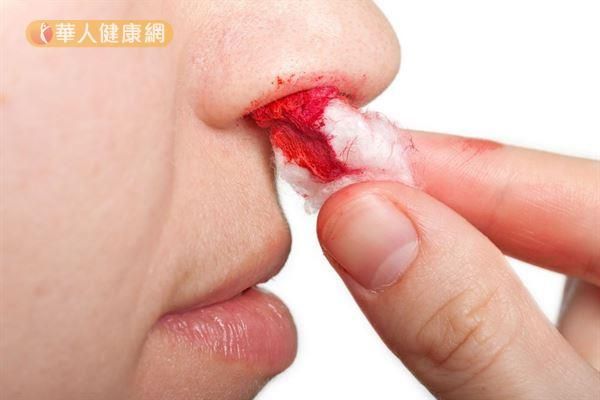 【李宗偉患癌】什麼是鼻咽癌？如發現有這7個症狀，你就要注意了！
