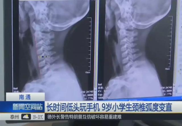 別再用手機哄孩子，手機對孩子的傷害，堪比以前的「鴉片」