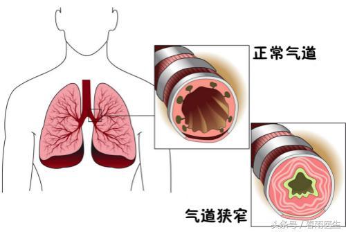 沒動兩下就氣喘吁吁，只是因為缺乏運動？