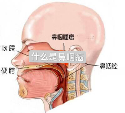 認識什麼是鼻咽癌？     