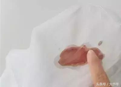 衣服不管染上什麼，用這招都能洗掉，太實用了！
