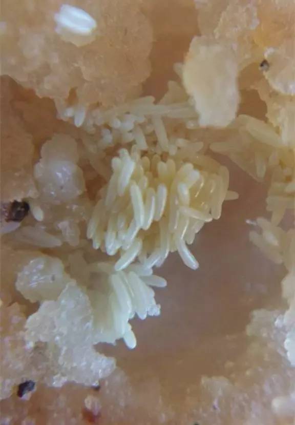 密集恐懼症有救啦，這裡有完善的治療方法！