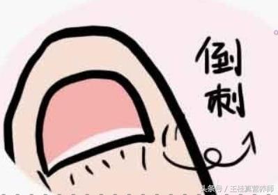 手指上有倒刺，您可以別再直接撕掉，已經有人因此而截掉手指
