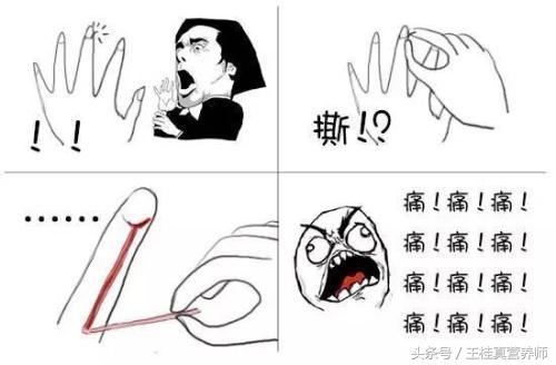 手指上有倒刺，您可以別再直接撕掉，已經有人因此而截掉手指