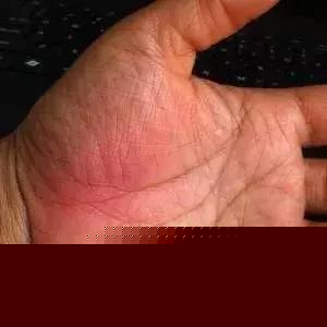 手掌上這塊肉，一看就知道你身體好不好，很靈哦！