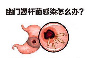 幽門螺桿菌危害有多大？如何判斷幽門螺桿菌是否被消滅乾淨了？