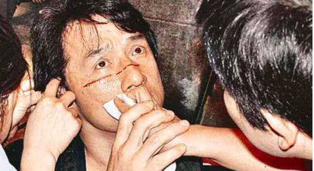 64歲成龍走路要拄拐，腳傷嚴重需手術，卻一直拖延治療時間，原因..
