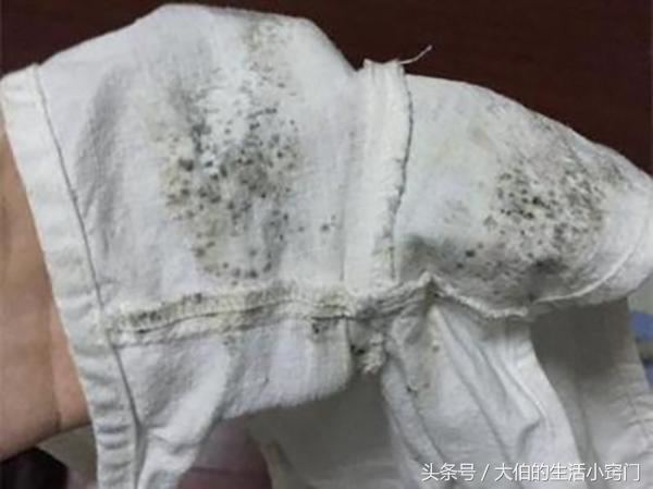 衣服過一個季節拿出來全發霉... 大伯教我幾個土方法，「去除霉斑」乾淨溜溜！