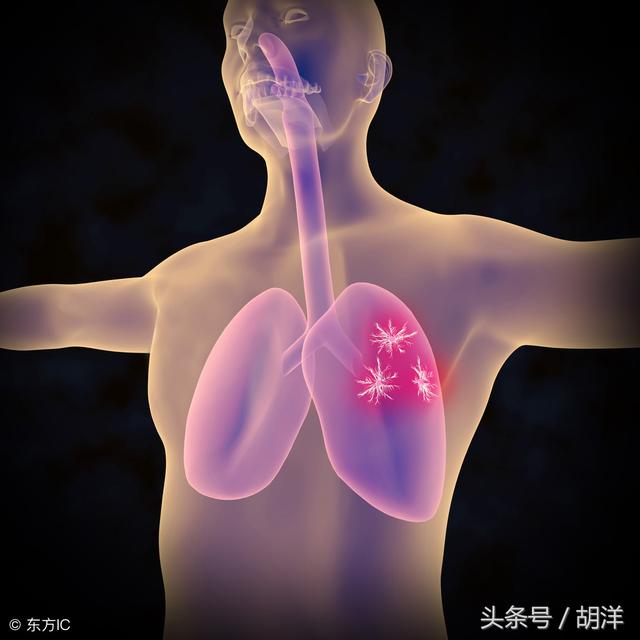前半生吸菸，後半生吸氧，這句話到底是不是真的，醫生說出大實話
