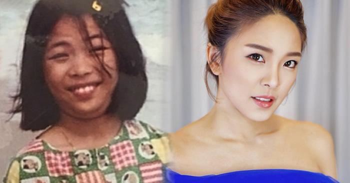 醜小鴨變天鵝！整形美女收「1億聘金嫁豪門」，結婚三個月「秒離婚」...她怒吼：「我受夠了！ 