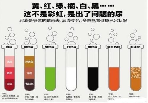 夜尿多，身體很可能在「暗示」5件事！醫生勸你別再忽視了！
