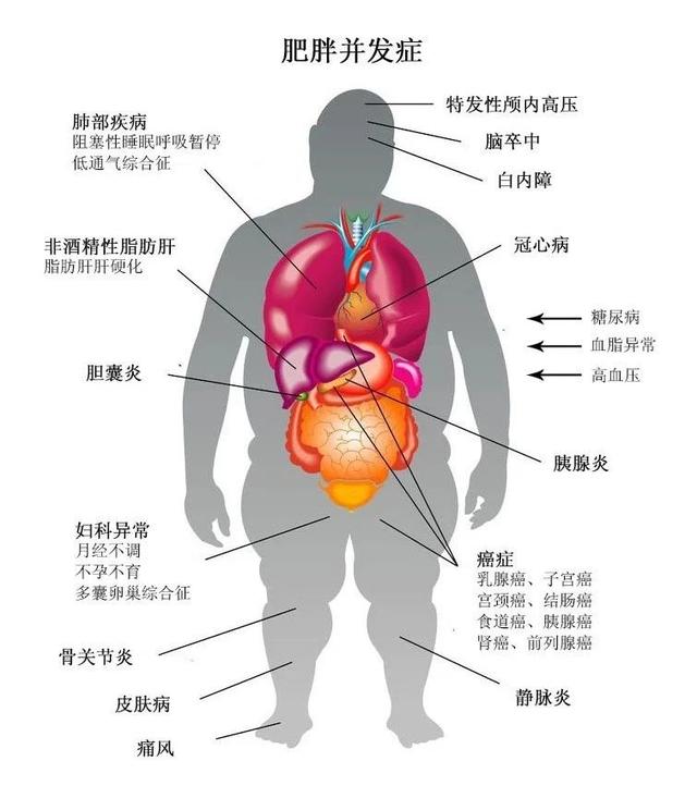 日本肥胖率全球最低，而中國胖子越來越多，3個飲食習慣一定要學