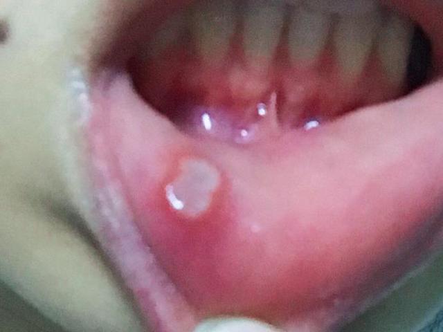 睡懶覺的5大危害，知道後你還敢早上賴床嗎？