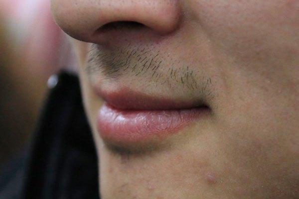 嘴唇顏色異常，其實是身體在給你「提醒」，這4種表現你要注意