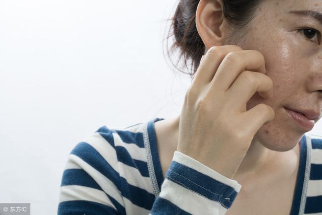 長了黃褐斑，不要急於求成，從內調理慢慢來